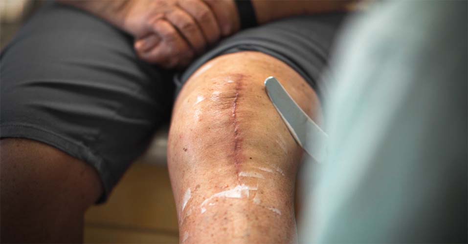 Optimal Therapy Wound Care